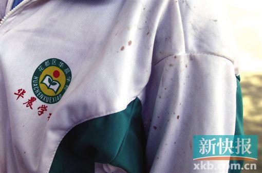 小学生称校车上遭老师咬伤并被打到在地(图)