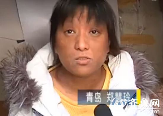 25岁女子两年前脸开始逐渐变黑