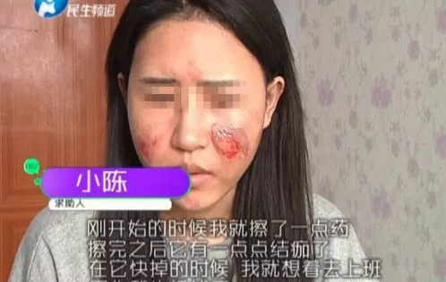 毁容女子