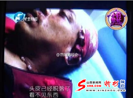 洛阳一顾客嫌上菜慢引争执 削掉店老板头皮