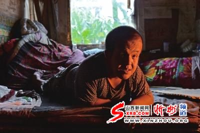 河北“大头娃娃”出生即患脑积水 与母蜗居30年